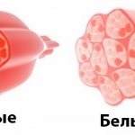 BigSovets.ru - The difference between red and white muscle fibers