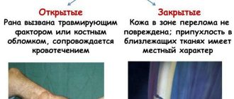 Джинтропин - инструкция по применению
