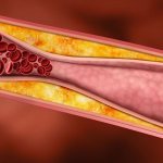 Холестирин