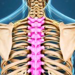 Как определить защемление нерва в грудном отделе. 5 признаков