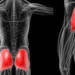 миозит ягодичной мышцы