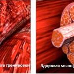 Соматотропин