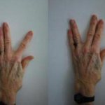 упражнения для пальцев рук для кистей